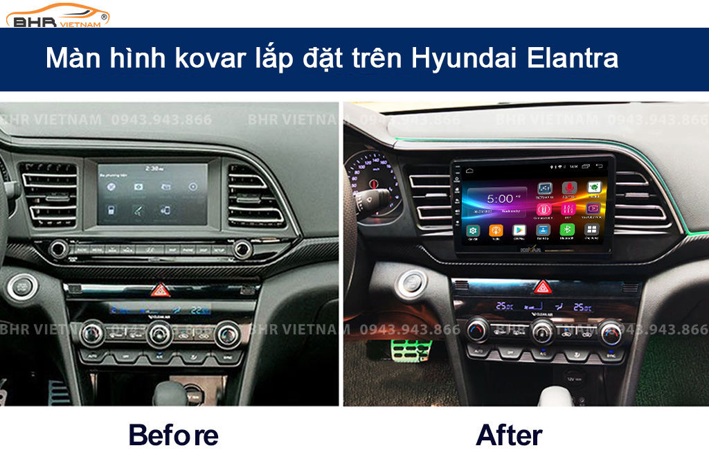 Hình ảnh trước và sau khi lắp màn hình DVD Kovar Plus 360 Hyundai Elantra 2016 - nay